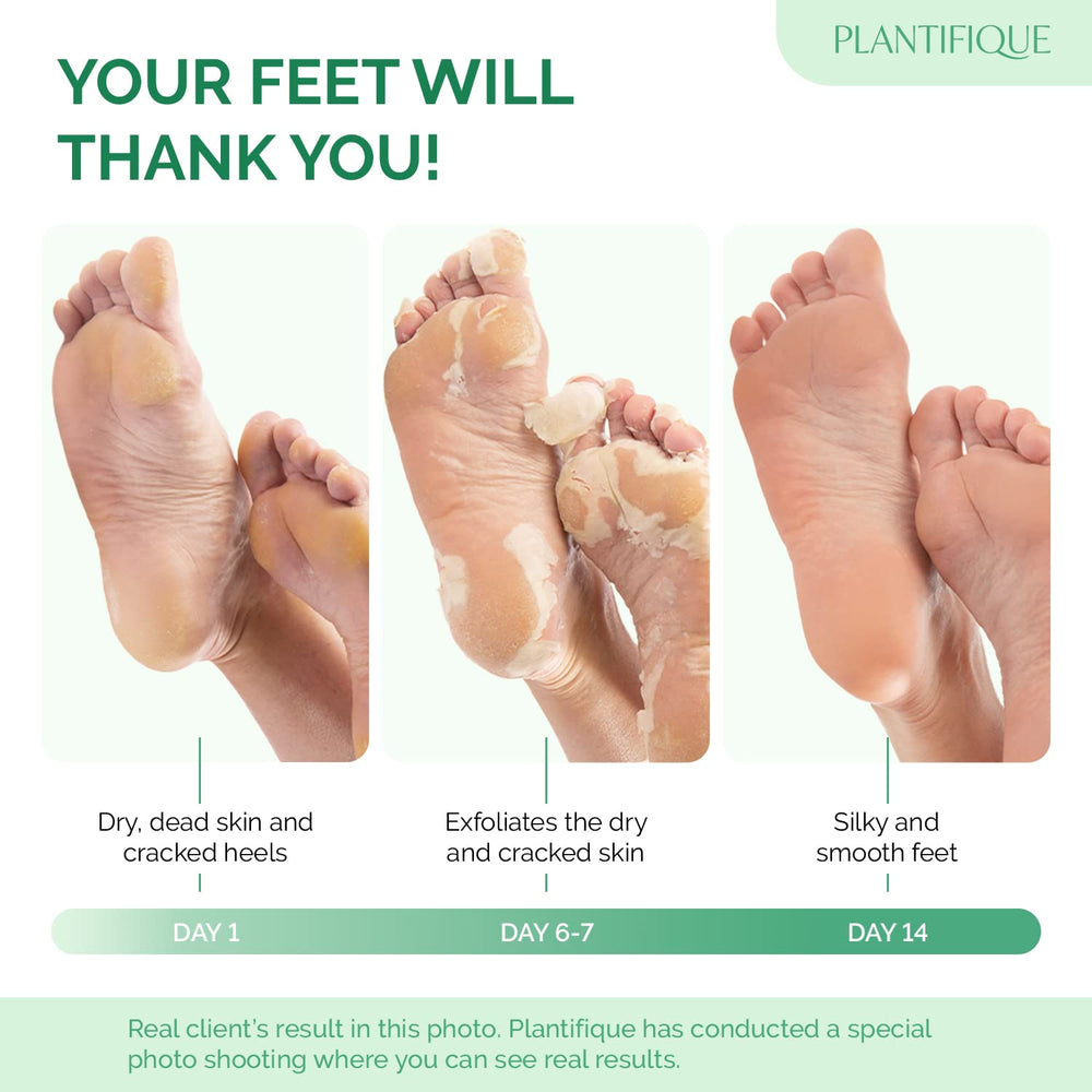 PLANTIFIQUE Foot Peel Mask Peach feet soaking scene to soften dry skin before peeling.