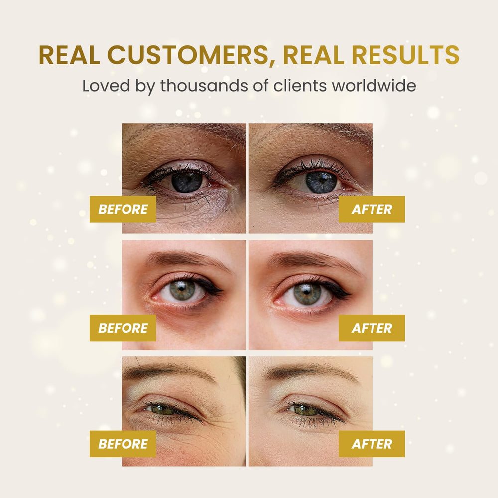 PLANTIFIQUE Gold Eye Patches application demonstrates convenient at-home rejuvenation ritual.