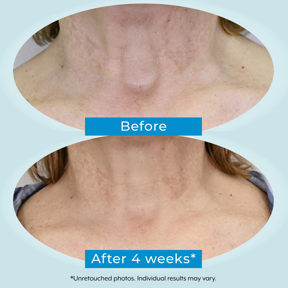 Plexaderm Dual Action Repair neck cream application routine—nighttime hydration reduces crepey appearance.