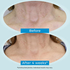 Plexaderm Dual Action Repair neck cream application routine—nighttime hydration reduces crepey appearance.