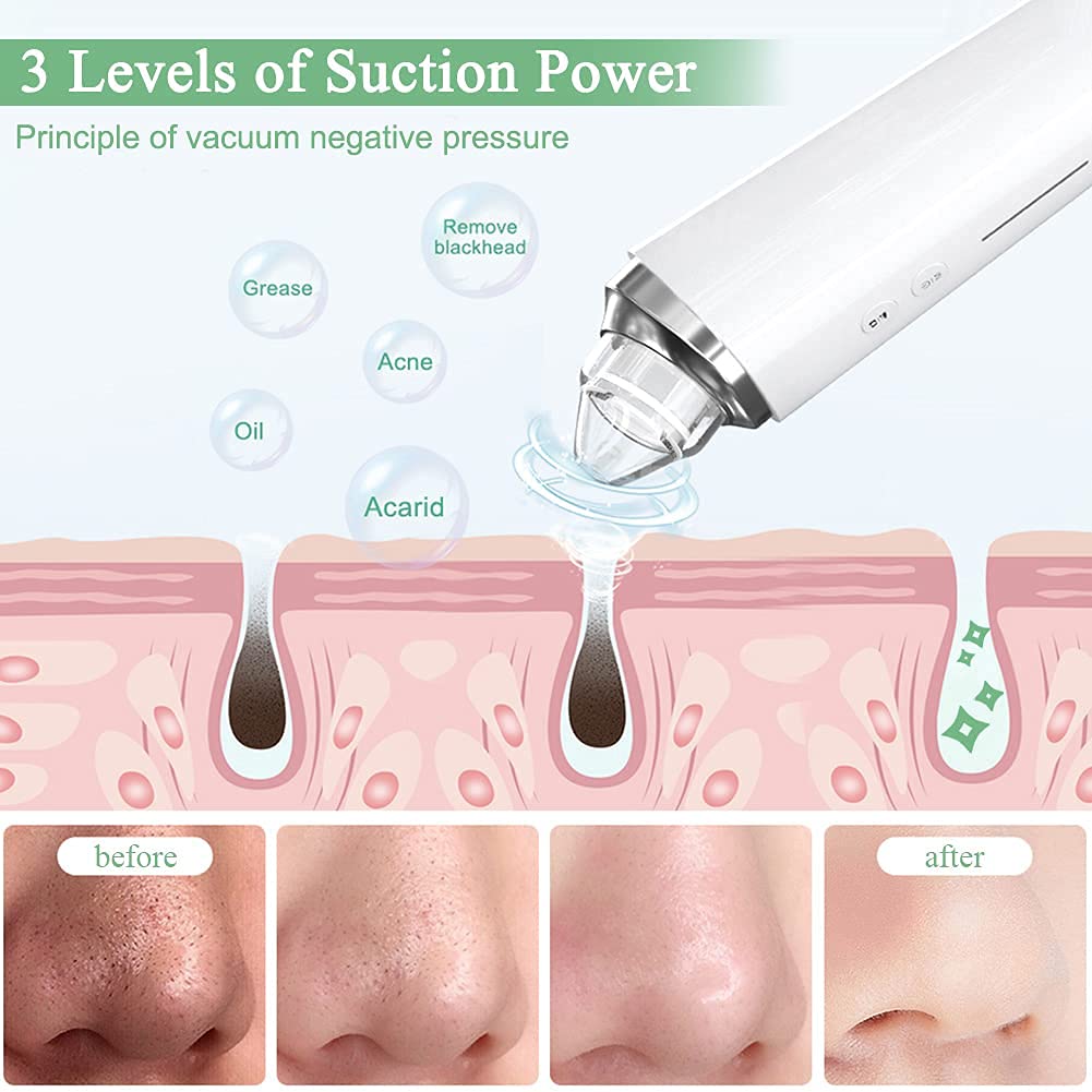 Prabensei blackhead remover kit includes six probes for versatile pore cleaning.