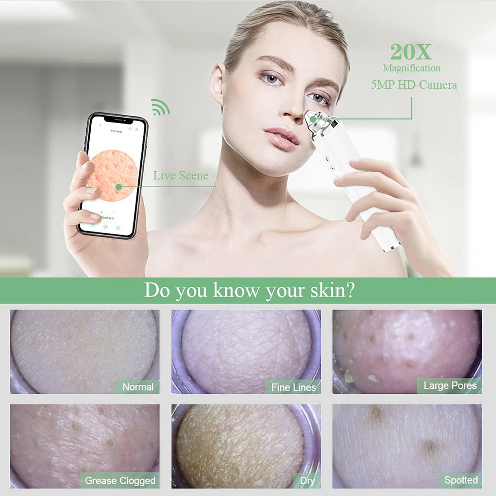 Prabensei blackhead remover with WiFi shows live feed for easy at-home skin sessions.