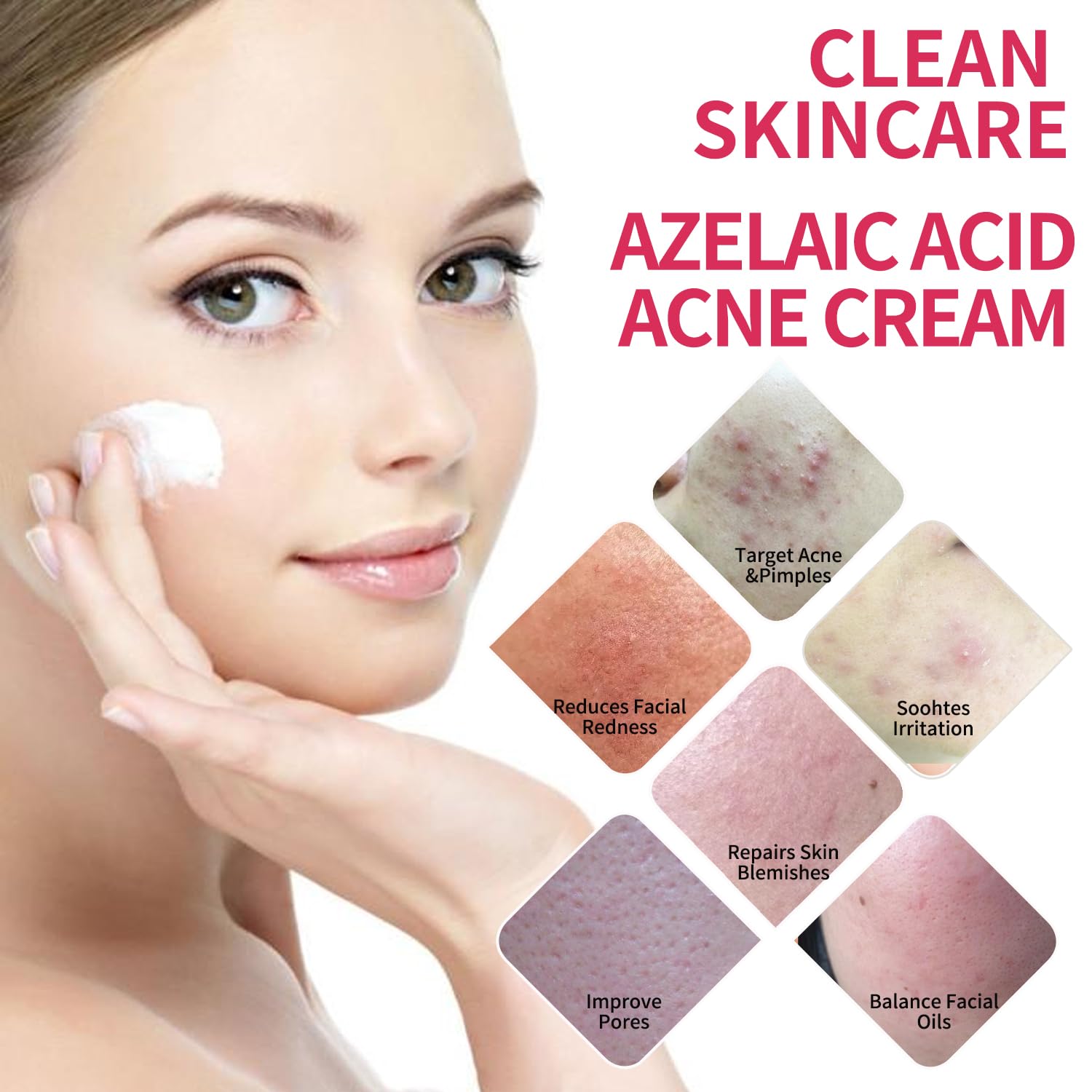 Premium Azelaic Acid Cream bottle designed for daily use