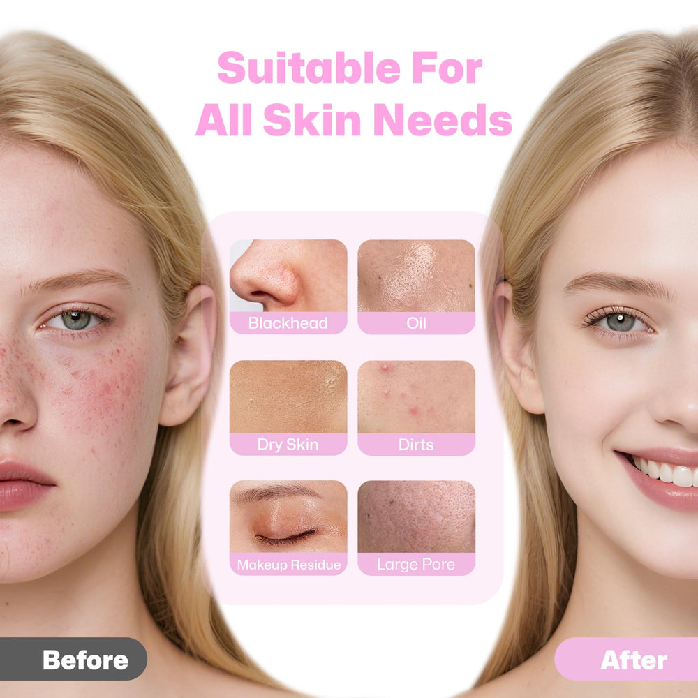PRITECH pores and blackheads treatment through reinforced bristles for deep cleaning