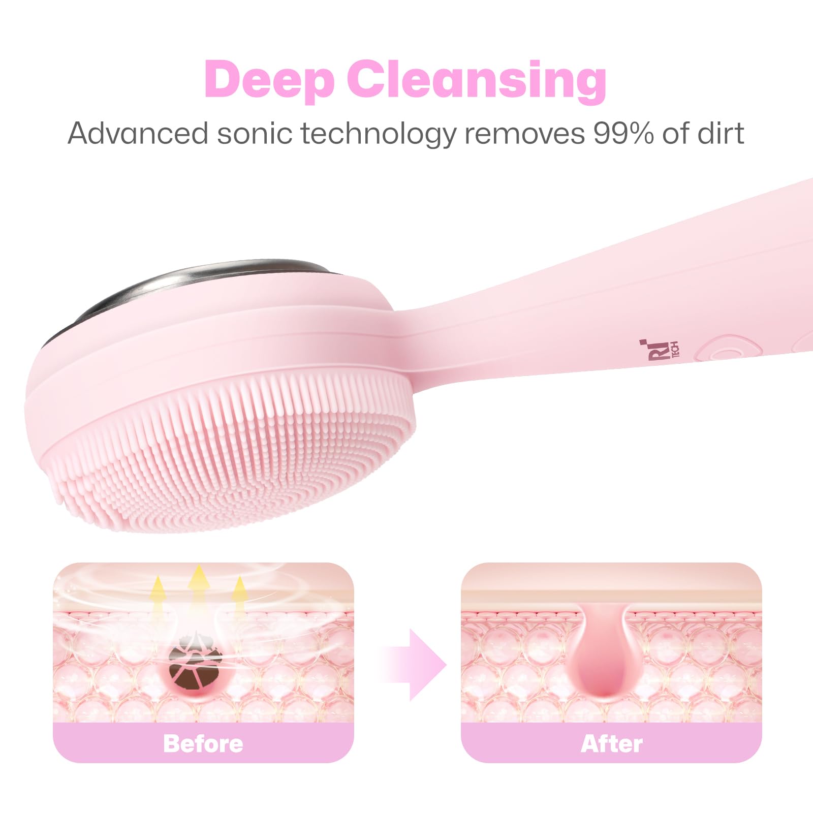 PRITECH silicone bristles target the T-zone for deep pore cleaning