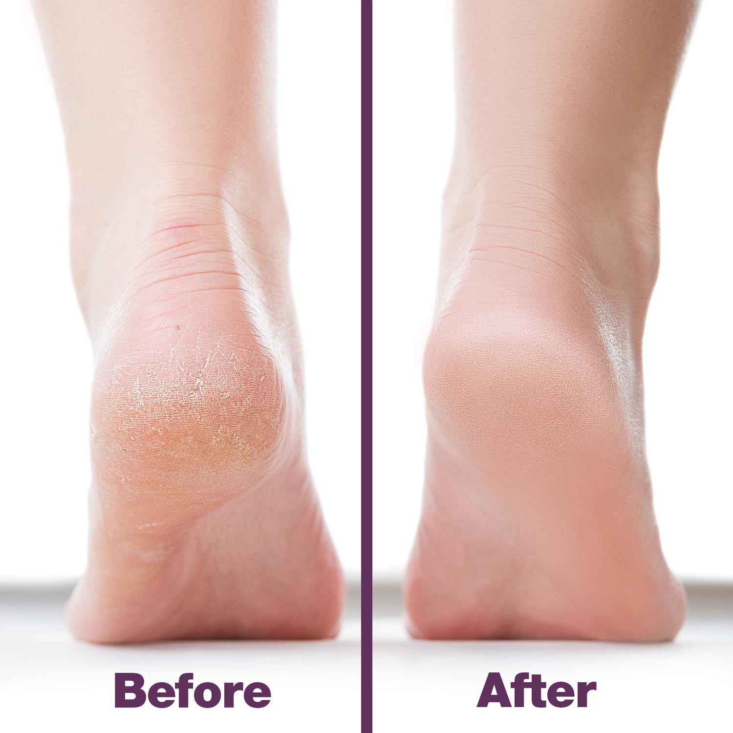 Probelle ergonomic handle demonstrates comfortable grip during pedicure.