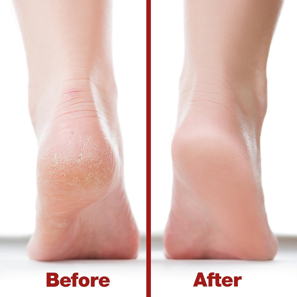 Probelle handle detail highlighting durable comfortable grip for steady pedicures.