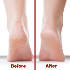Probelle handle detail highlighting durable comfortable grip for steady pedicures.