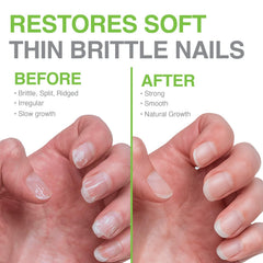 Probelle Nail Hardener Formula 1 strengthening nails during regular application.