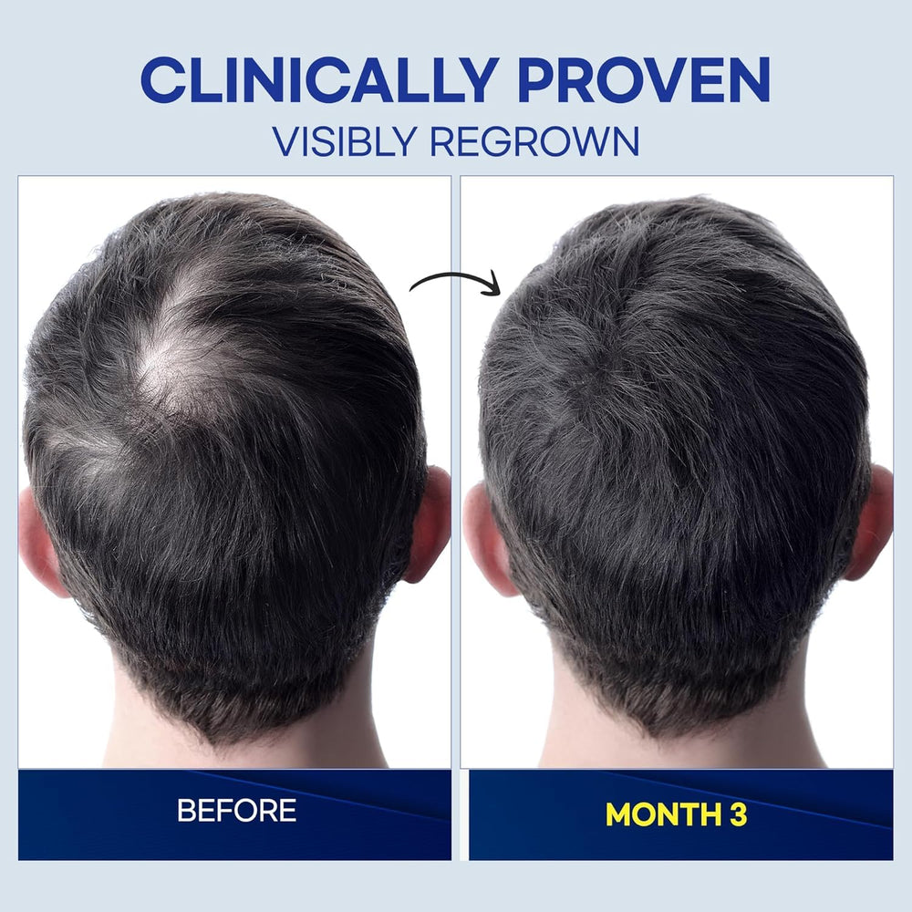 ProBliva formula appears non-greasy with quick absorption on scalp.