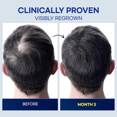 ProBliva formula appears non-greasy with quick absorption on scalp.