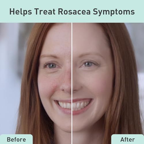 PROcure Rosacare: hialurónico para hidratación profunda.