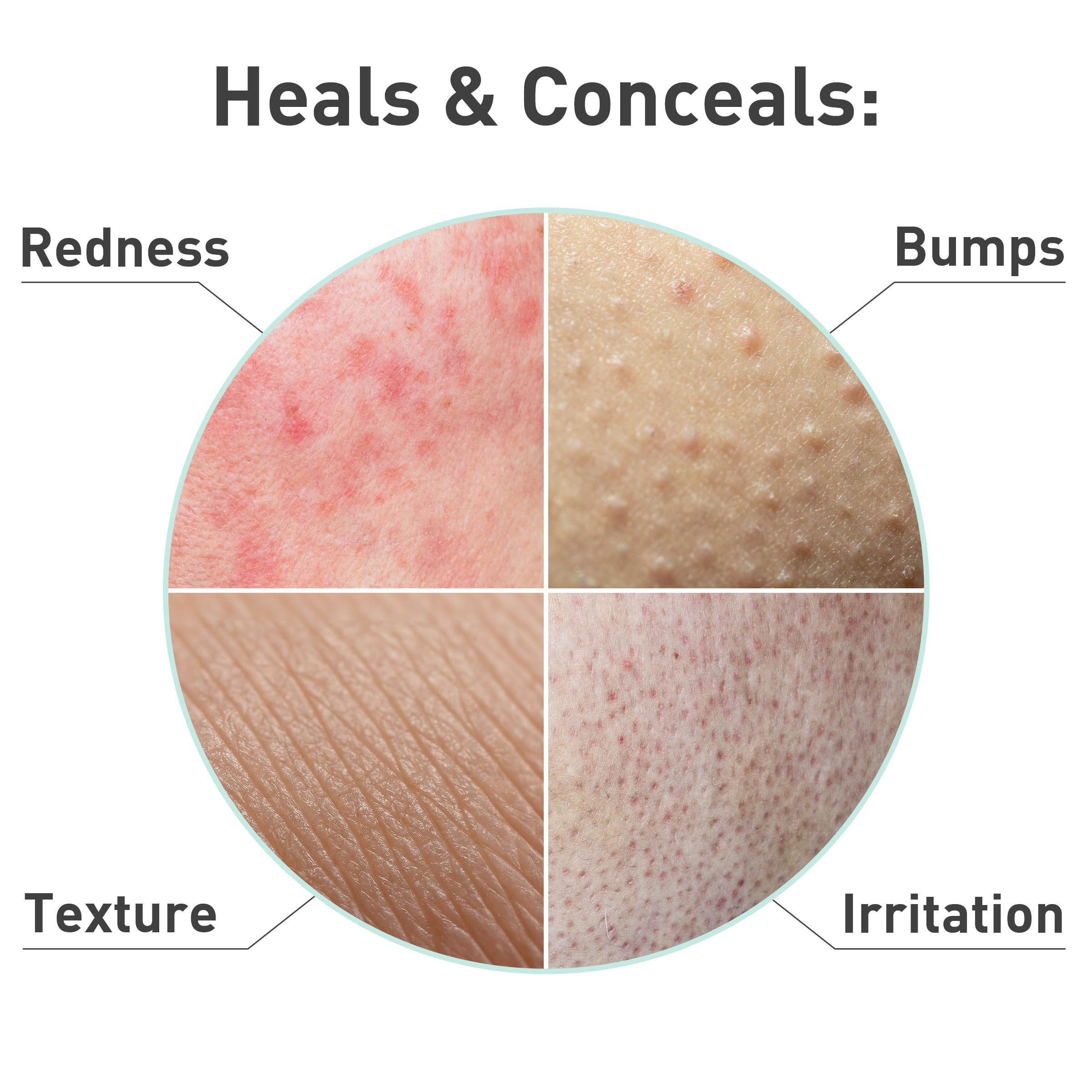Rosacare Serum with hyaluronic acid delivers deep hydration.