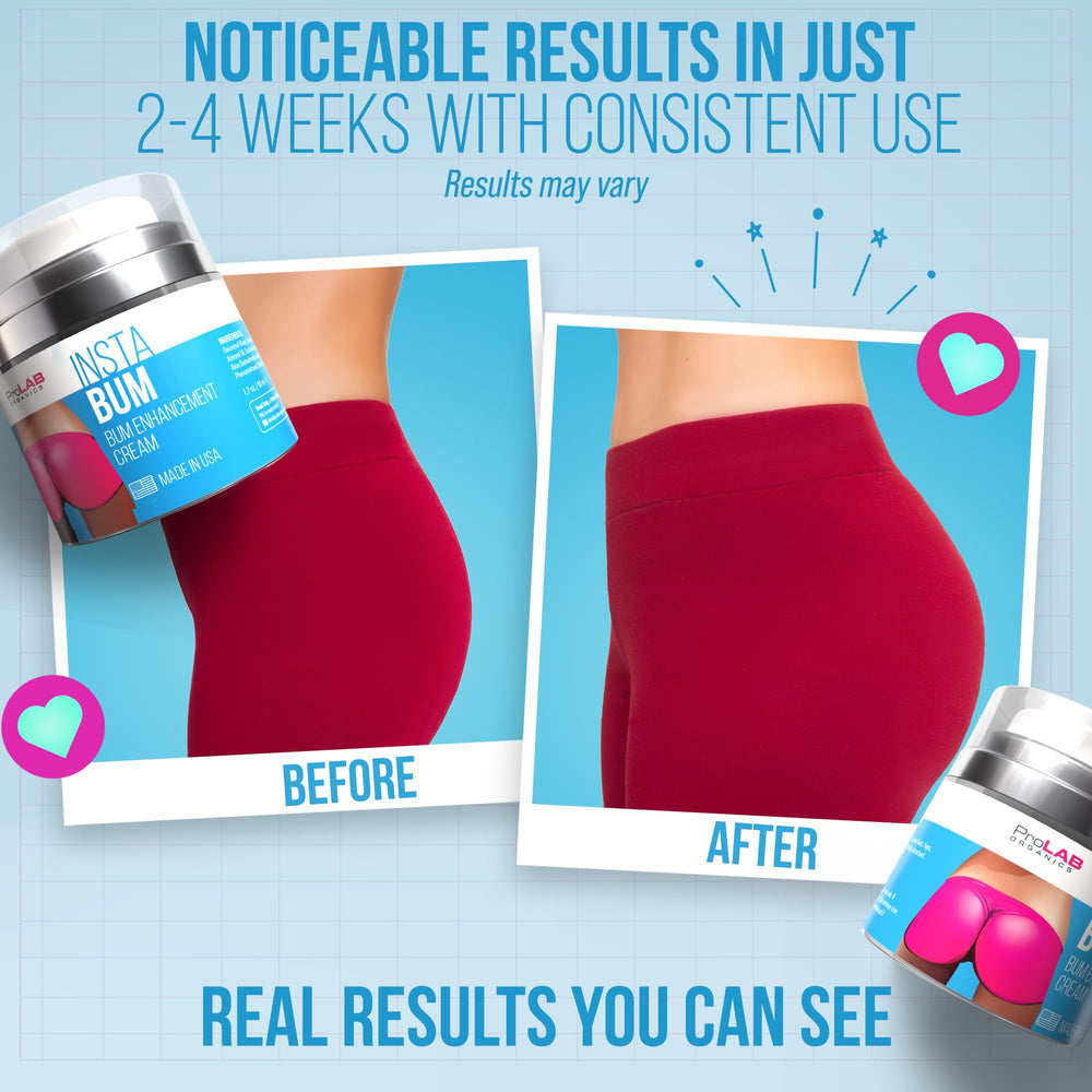 VoluPlus visualization emphasizing contouring and plumper-looking skin.