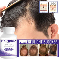 Pronexa Propidren capsules-closeup highlights small capsules designed to support ongoing hair growth routines.