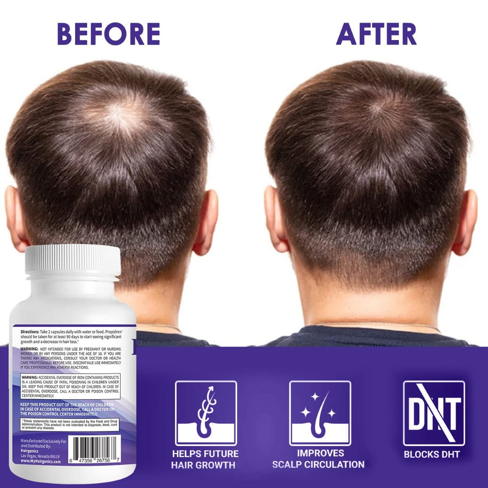 Pronexa Propidren green-tea-extract promotes antioxidant-rich formula for nourishing scalp health.