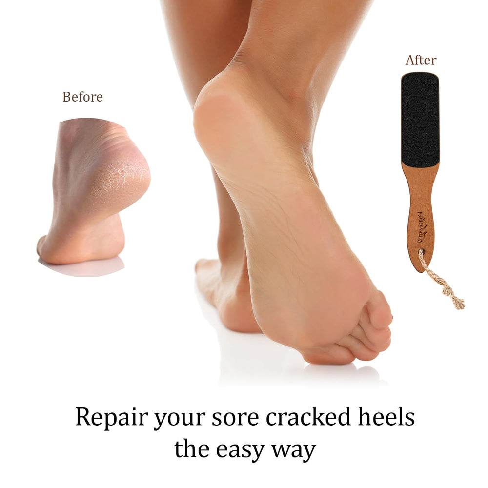 Pumice Valley coarse-grit sandpaper for removing hard, dead skin and calluses.