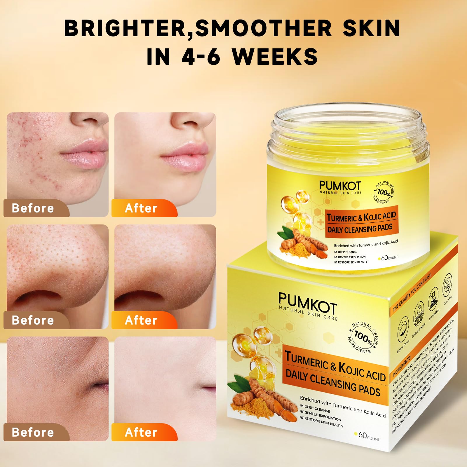 Pumkot pads on face in gentle circular cleanse for everyday use