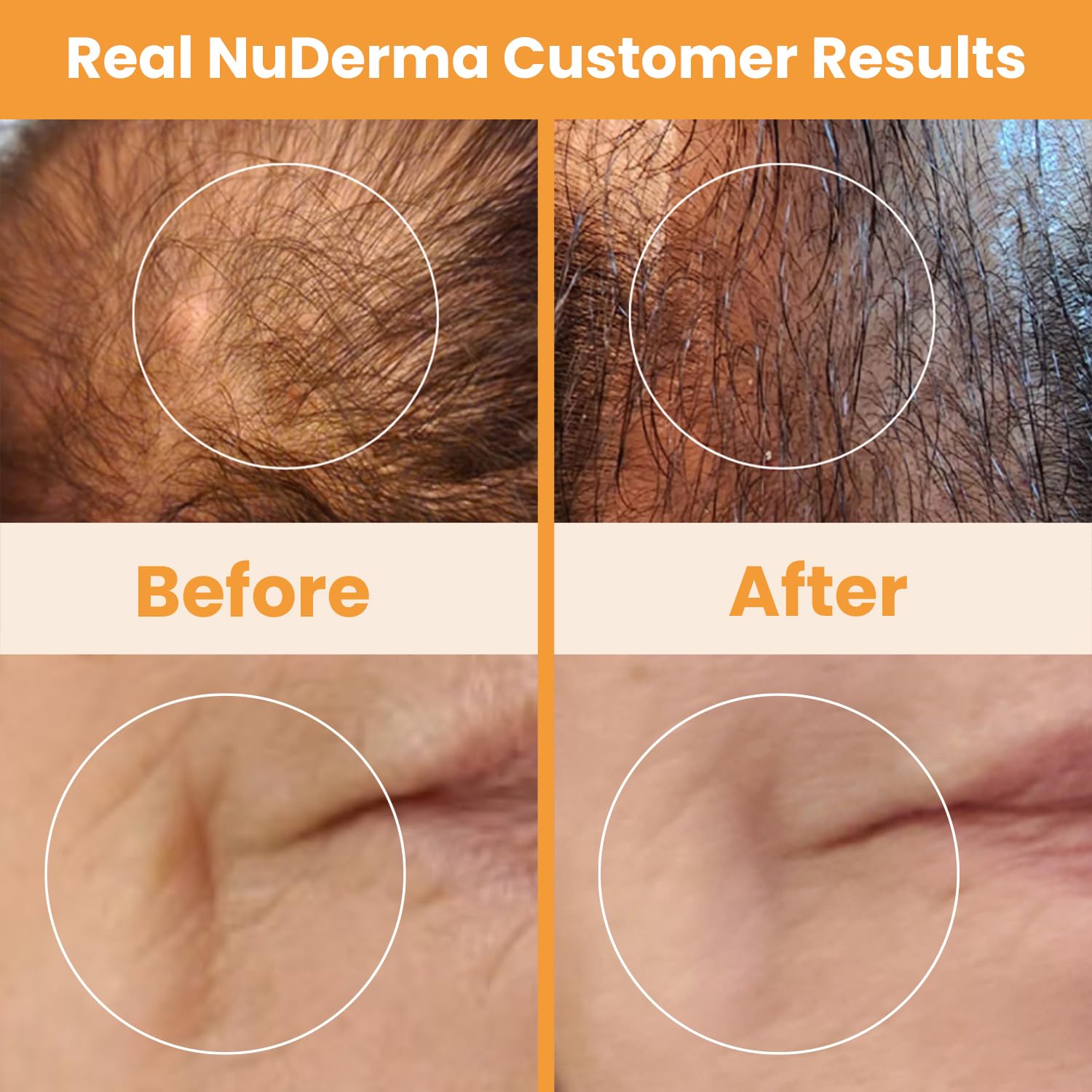 Pure Daily Care NuDerma box includes quick start guides and manual