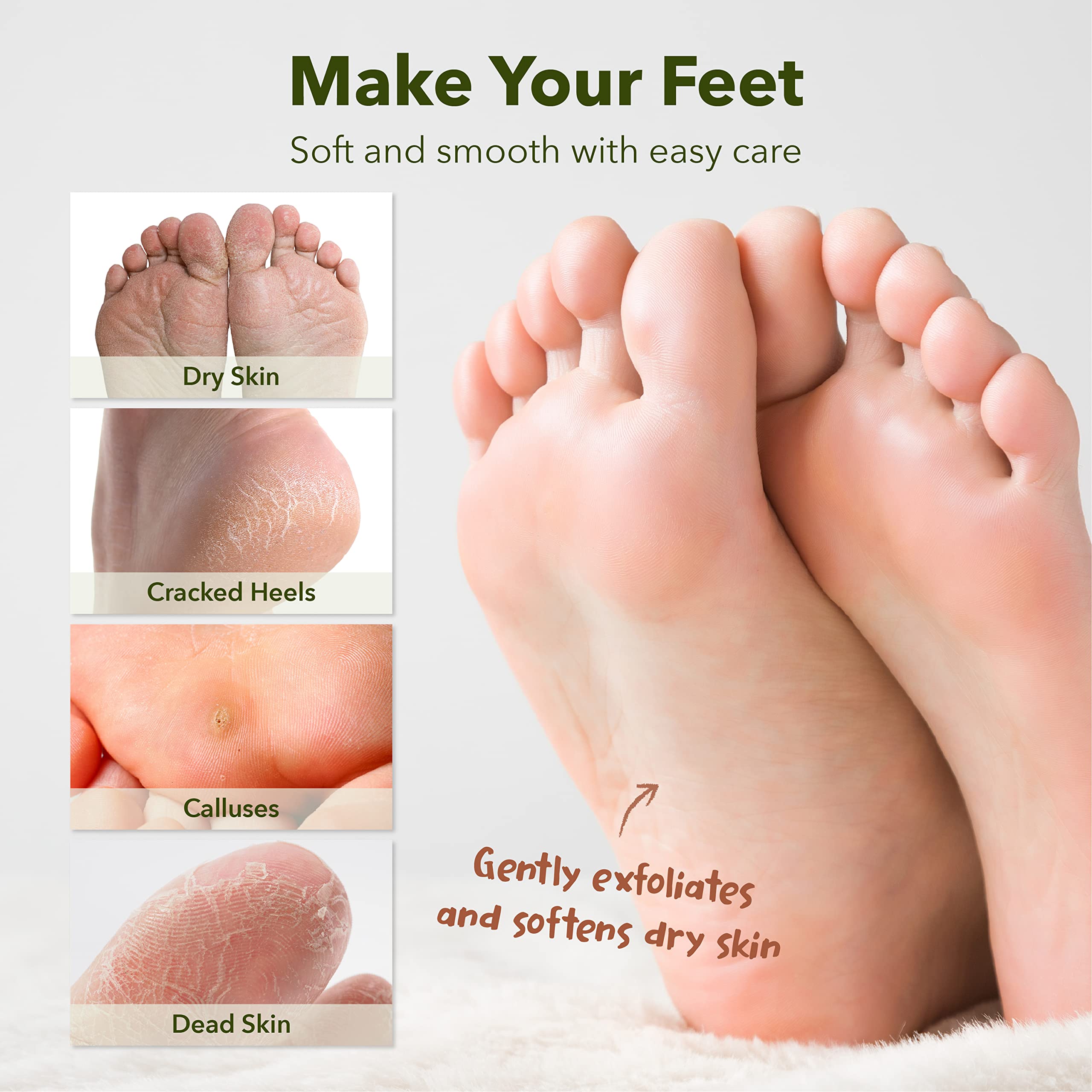 Purederm peel-off process demonstrates exfoliation leading to softer, smoother heels.