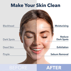 Purederm wash-off mask removes dead skin and excess oil.