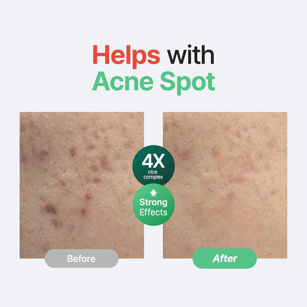 PURITO Centella Unscented Serum on-skin application, soothing after sun or irritation.
