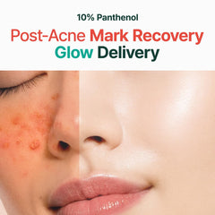 PURITO Panthenol 10% application steps closeup highlighting easy daily use for blemish-prone skin.