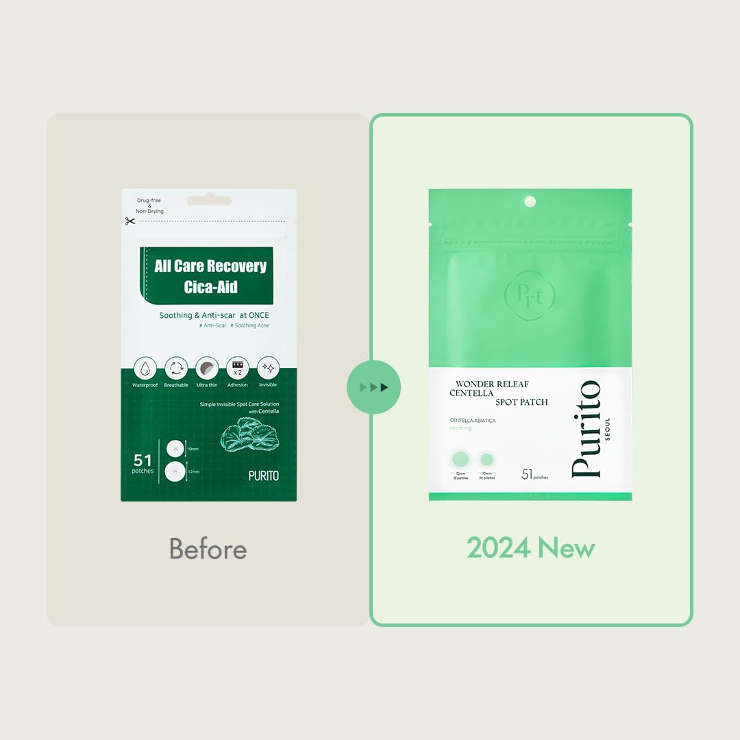 PURITO SEOUL Wonder Releaf Centella Spot Patch on face demonstrates invisible coverage for acne-prone skin.