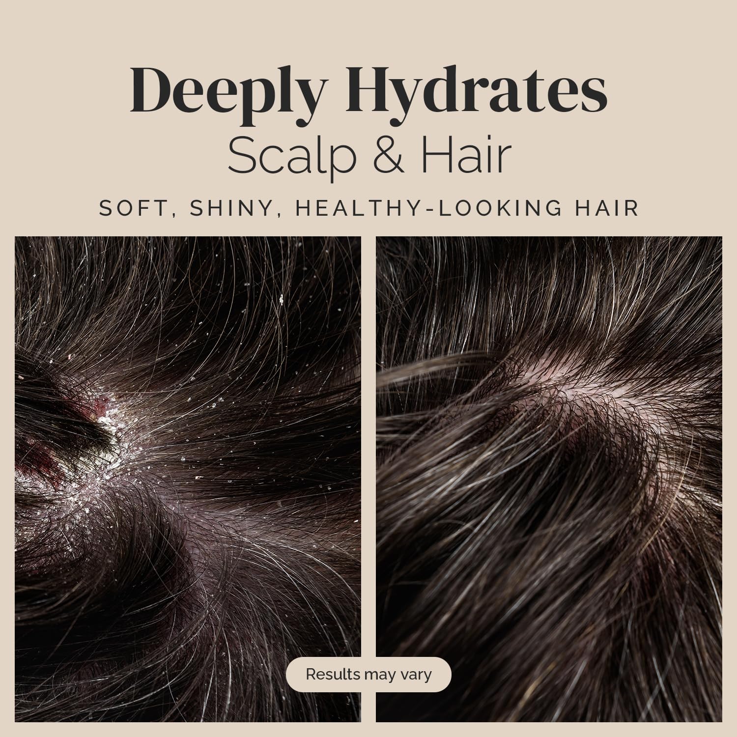 Puriya Tea Tree Clarifying Shampoo bottle highlights tea tree oil cleansing action.