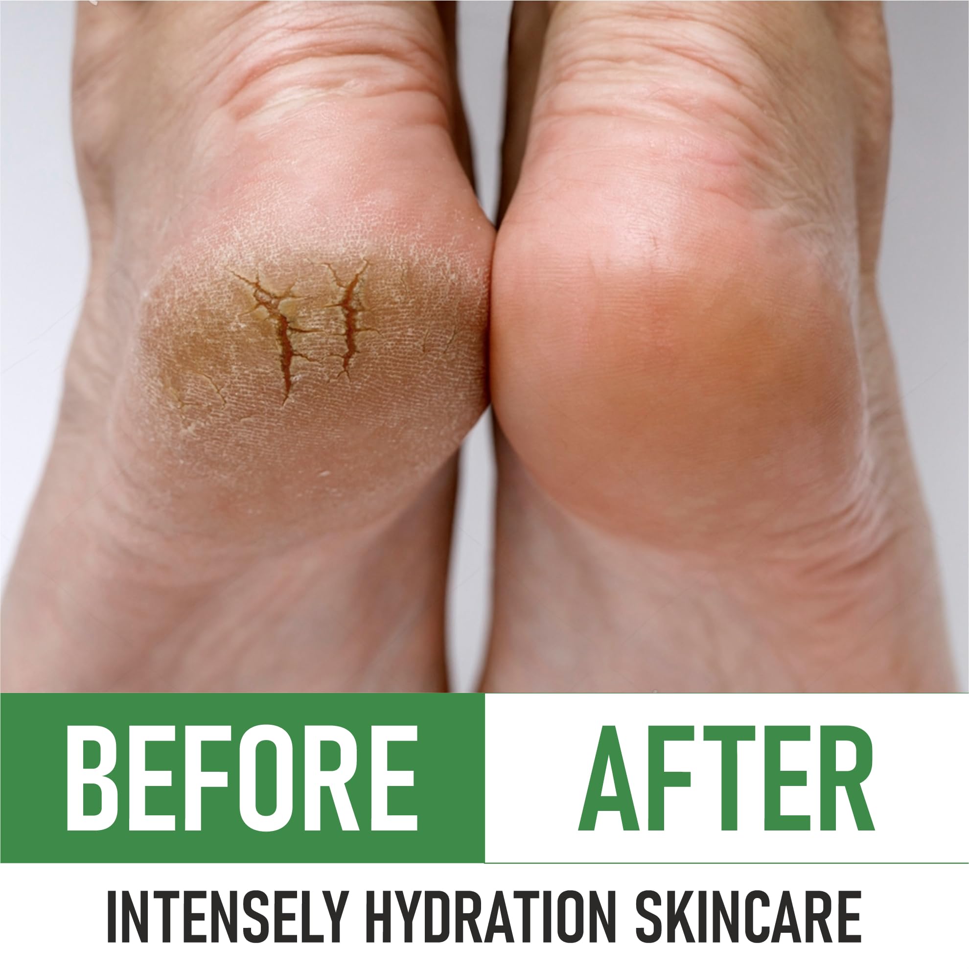 PurOrganica Urea 40% Foot Cream absorption shot emphasizes hydration