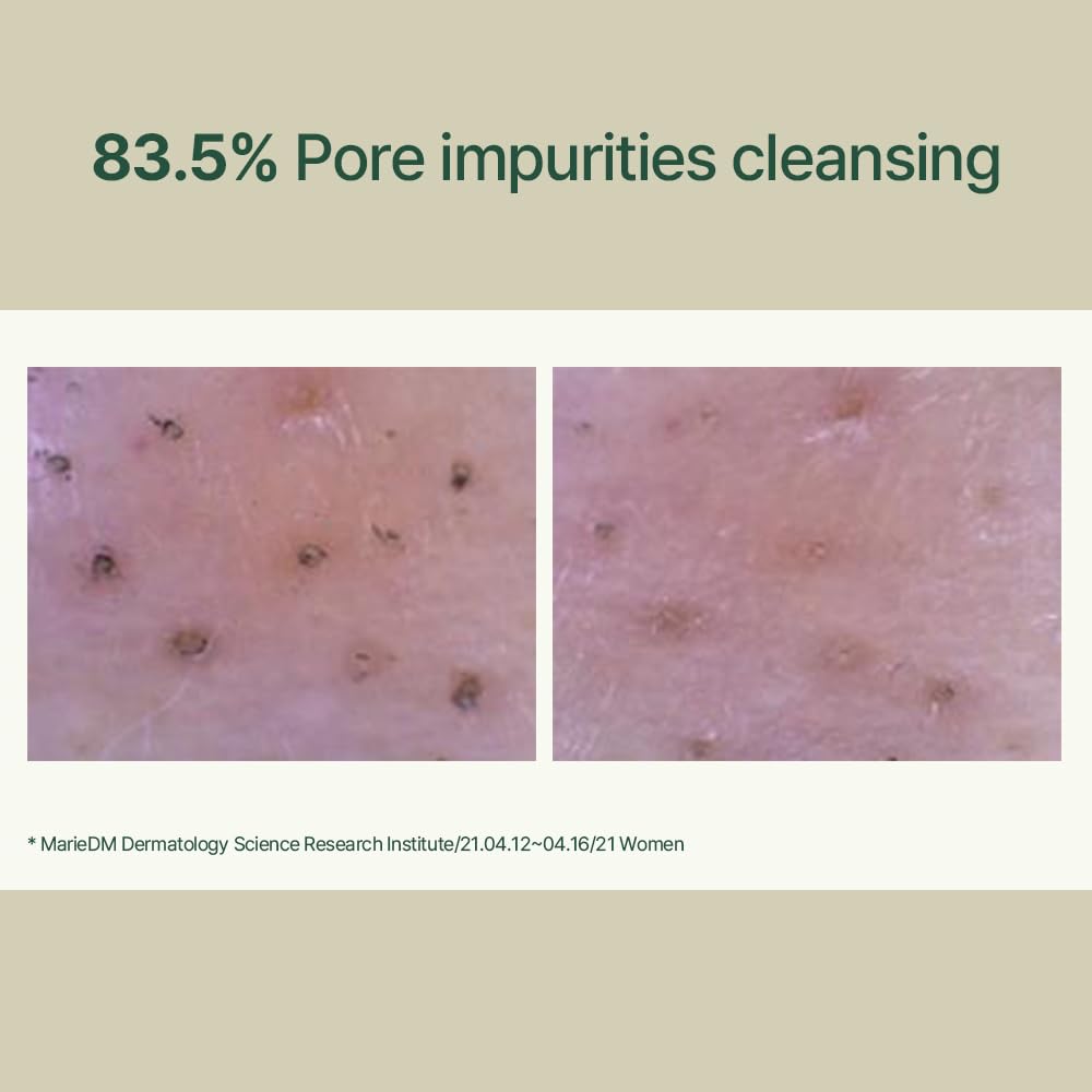 Pyunkang Yul PKY salicylic acid note suggesting gentle exfoliation.