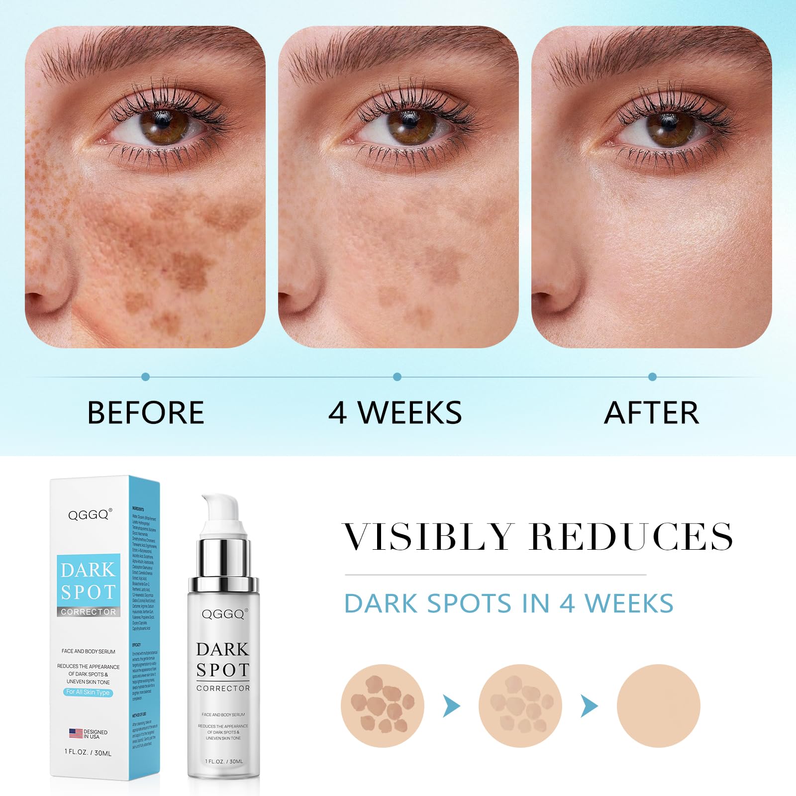 QGGQ dark spot remover application scene highlights easy daytime and nighttime use.