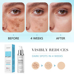 QGGQ dark spot remover application scene highlights easy daytime and nighttime use.