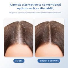 QGGQ Hair Growth Serum Roll-On applicator shows precise, mess-free delivery to thinning areas
