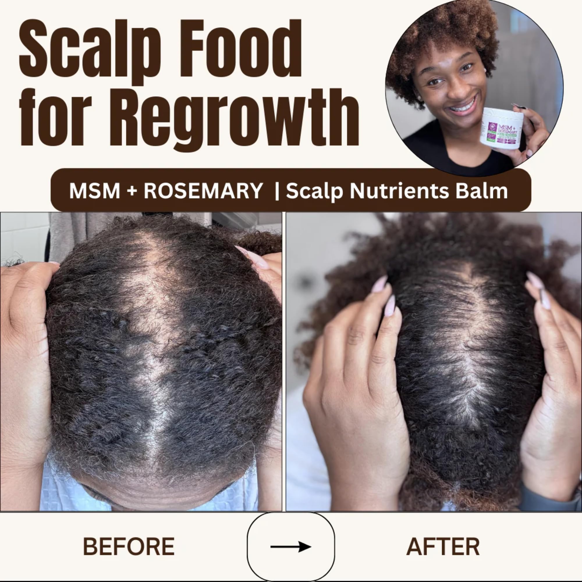 Illustrative before-after concept showing routine-based scalp care.