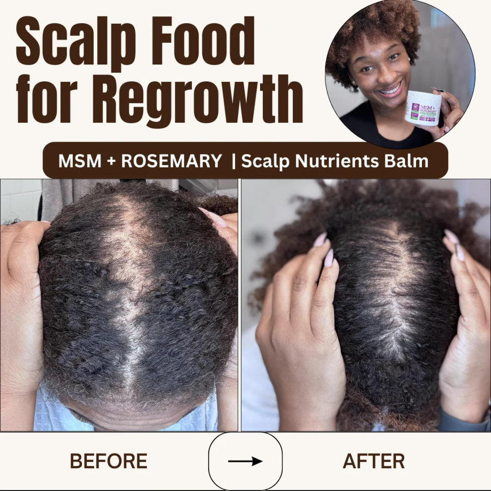 Illustrative before-after concept showing routine-based scalp care.