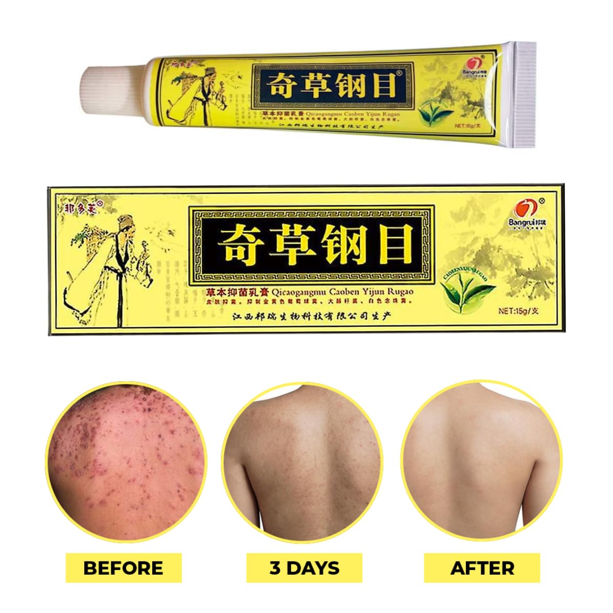 QICAOGANGMU herbal ingredients closeup highlights natural botanicals for soothing skin