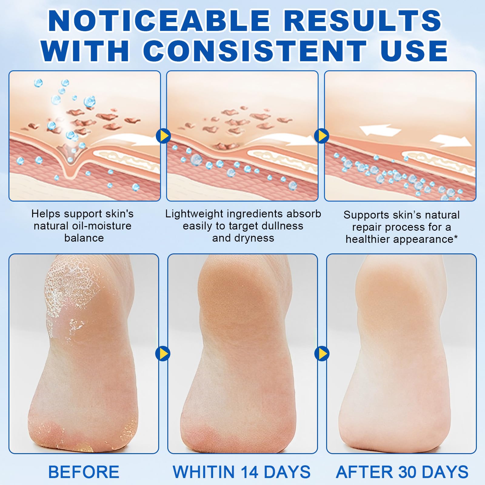 QJCWXIAOX urea foot care stick moisturizes dry skin on knees and elbows.