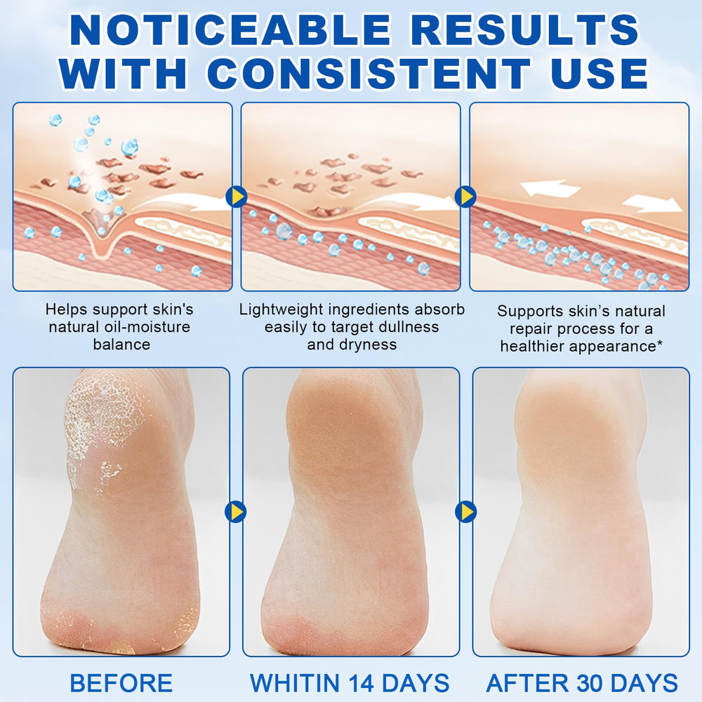 QJCWXIAOX urea foot care stick moisturizes dry skin on knees and elbows.