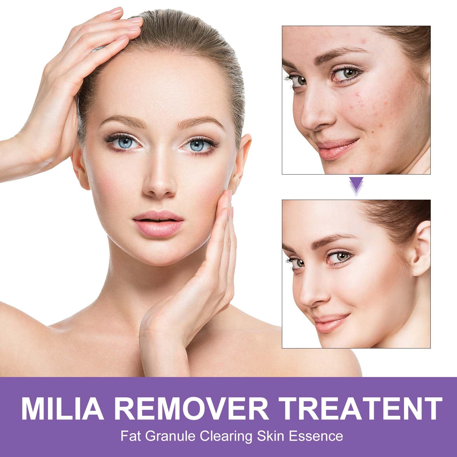 QKDBLWX Milia Remover texture swatch showing light non-greasy finish