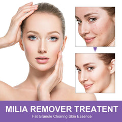 QKDBLWX Milia Remover texture swatch showing light non-greasy finish