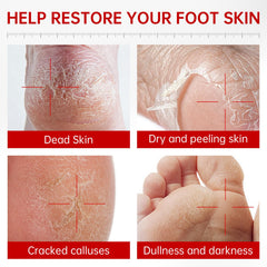 QQE Foot Peel Mask application on feet—easy, no-scrub exfoliation.