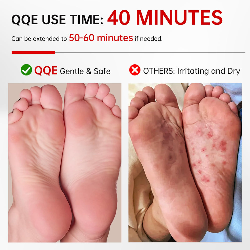 QQE Foot Peel Mask post-use skin shedding concept—potential renewal.