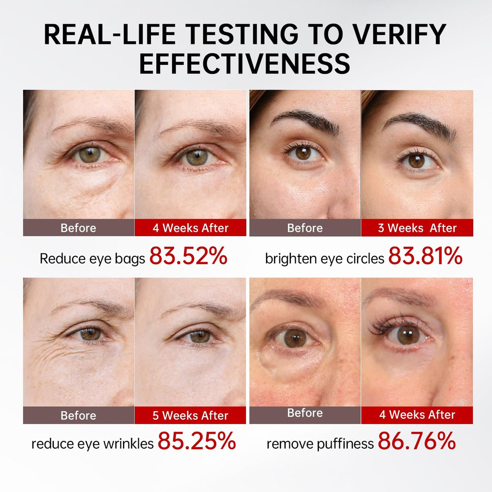 QQE Retinol & Caffeine Eye Serum roller applies near eyes with cooling action