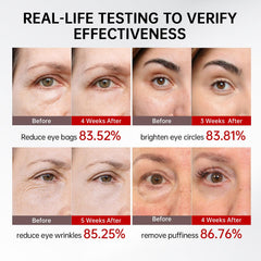 QQE Retinol & Caffeine Eye Serum roller applies near eyes with cooling action
