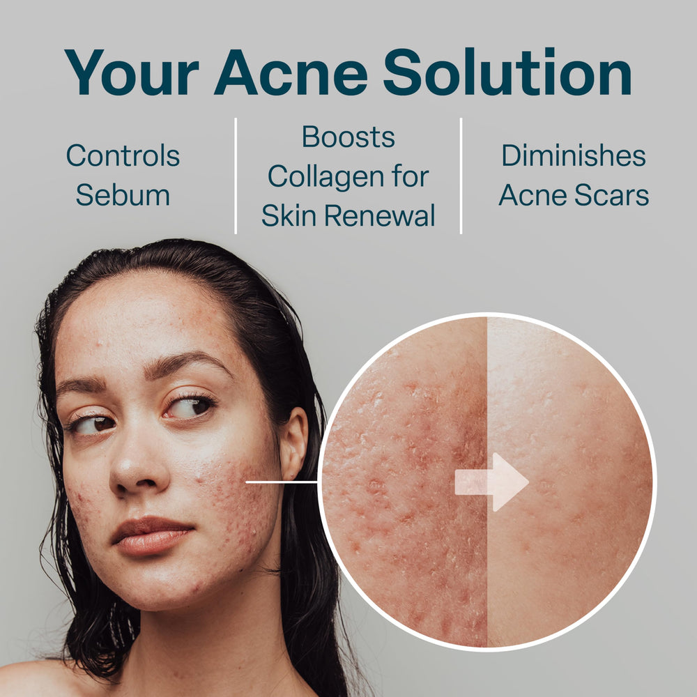 QRxLabs nonwoven pad texture closeup highlights gentle exfoliation.