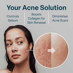 QRxLabs nonwoven pad texture closeup highlights gentle exfoliation.
