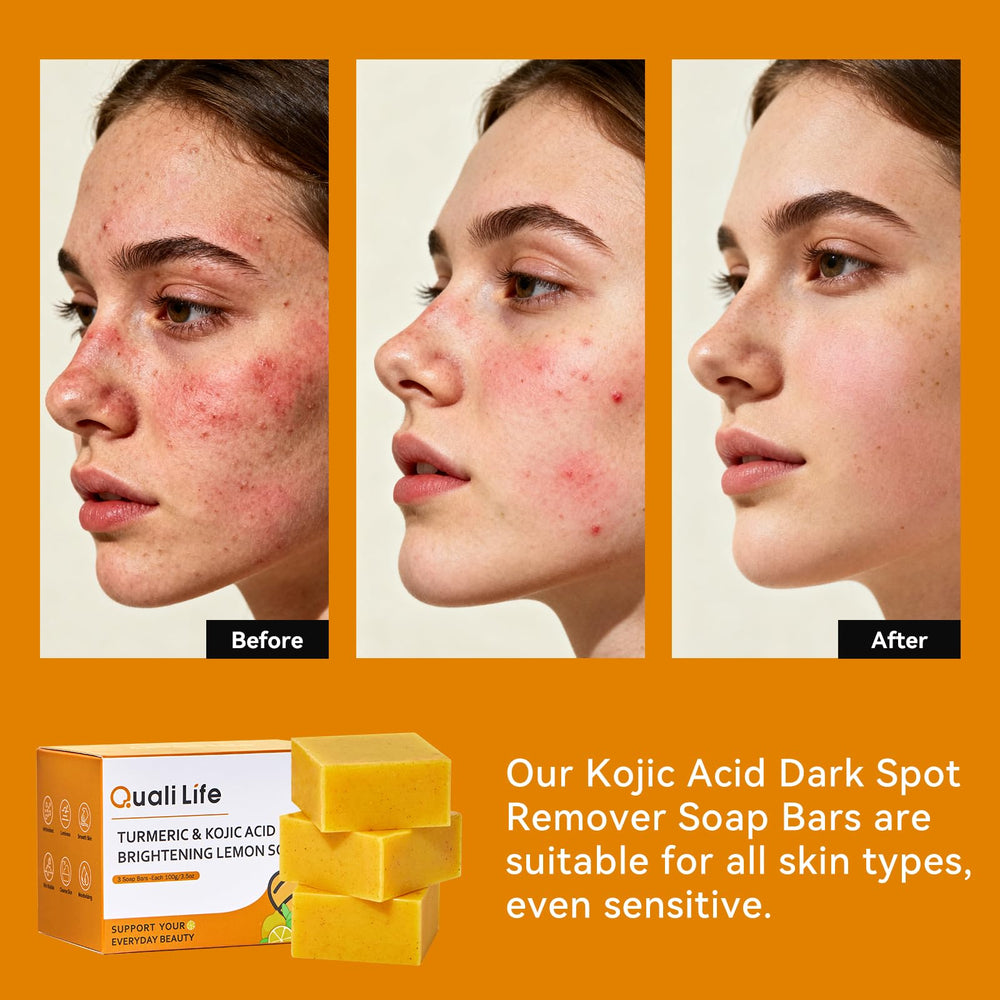QualiLife Kojic turmeric soap bar ingredients close-up featuring turmeric and vitamins