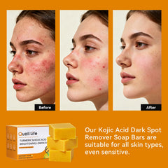QualiLife Kojic turmeric soap bar ingredients close-up featuring turmeric and vitamins