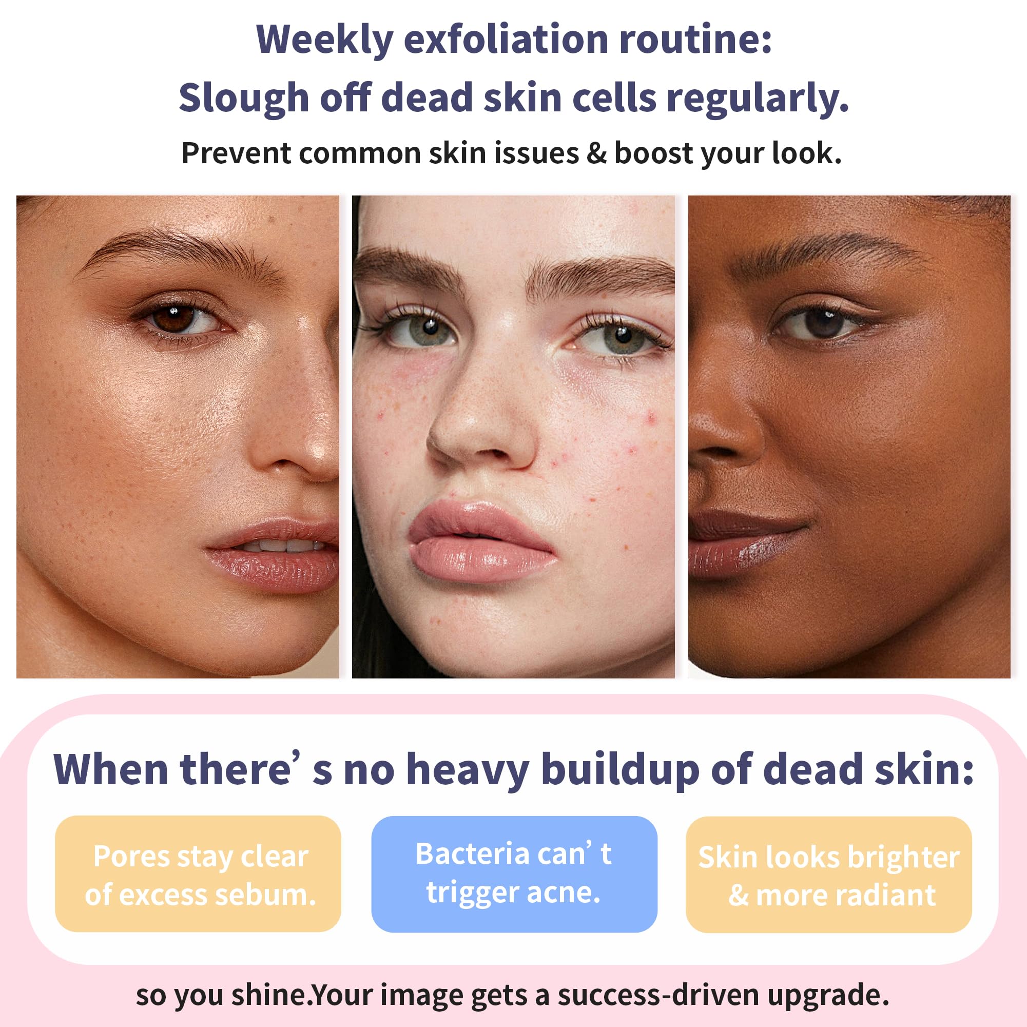 Quarxery Gentle Exfoliating Gel with witch hazel aloe ingredients highlighted